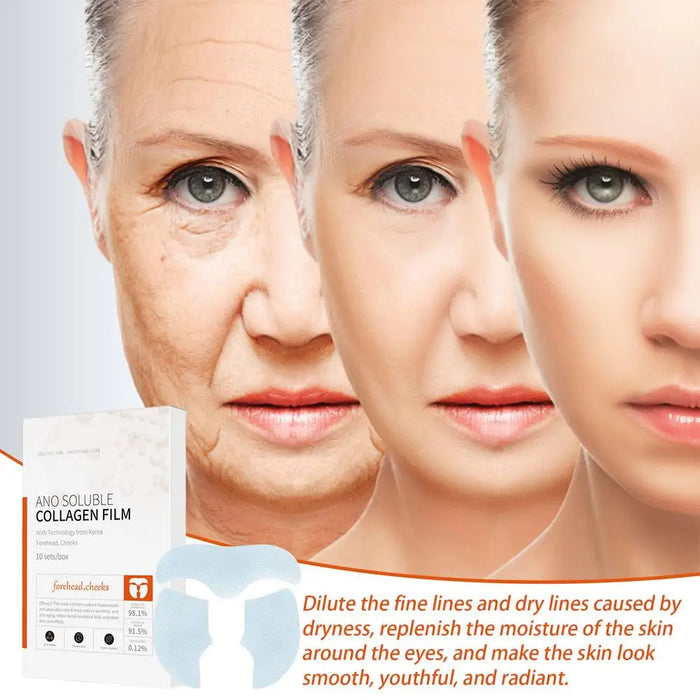 Vaderos™ Melting Collagen Films